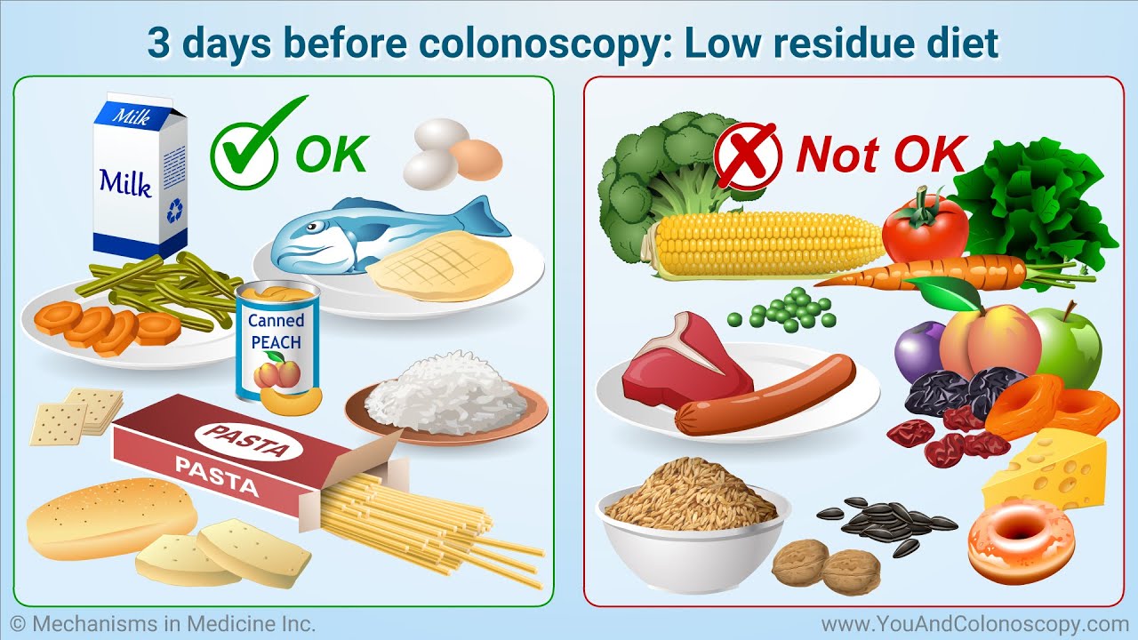 Meal ideas for colonoscopy preparation