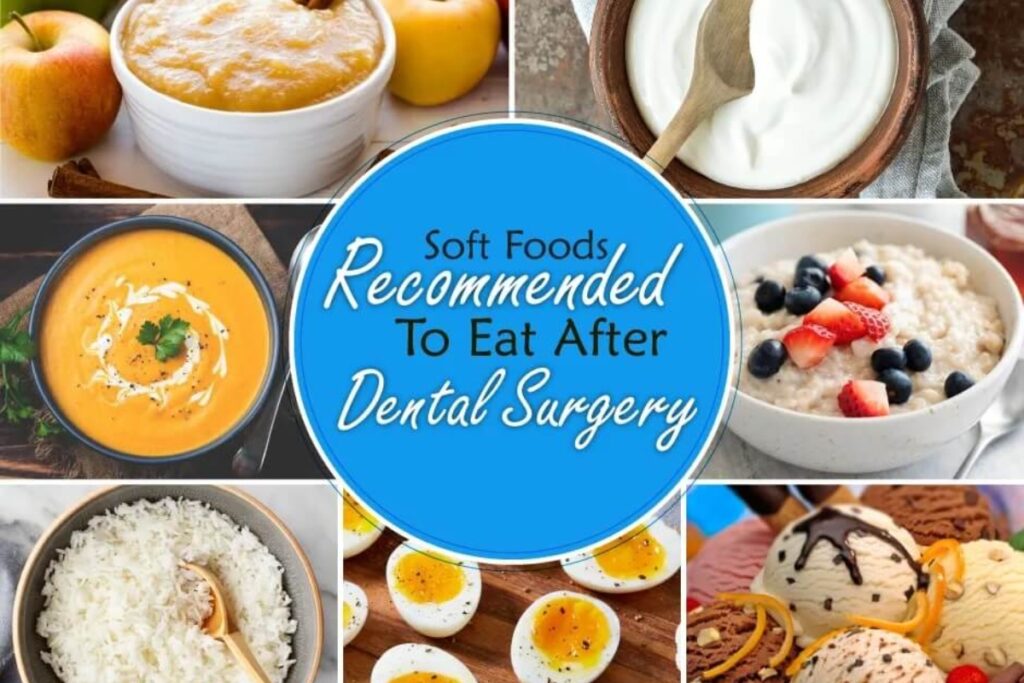 Essential Guide to a Soft Food Diet After Surgery: Improve Recovery in 2025